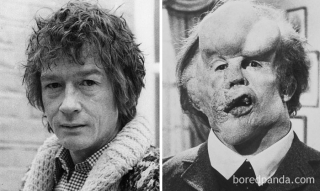 John Hurt - John Merrick, Człowiek słoń